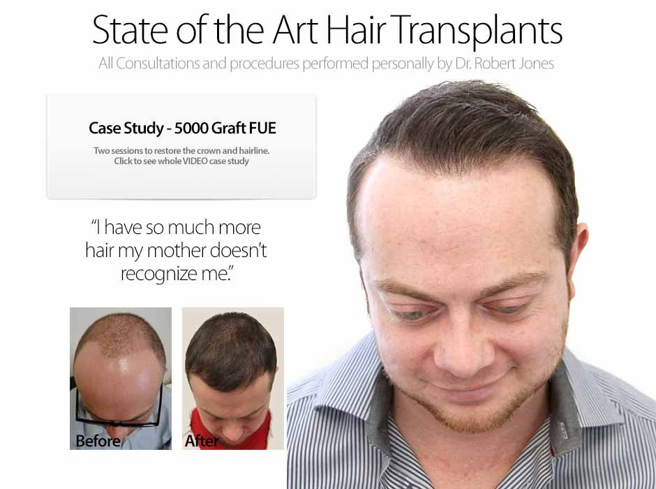 way to regrow lost hair